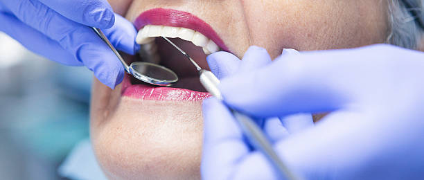 Best Emergency Treatment for Dental Infections or Abscesses in Brighton, AL